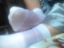 刚睡醒，有点痒啊，痒痒